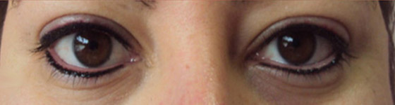 Micropigmentação de Olhos em Guarulhos