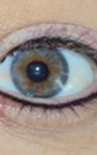 Micropigmentação de Olhos em Guarulhos